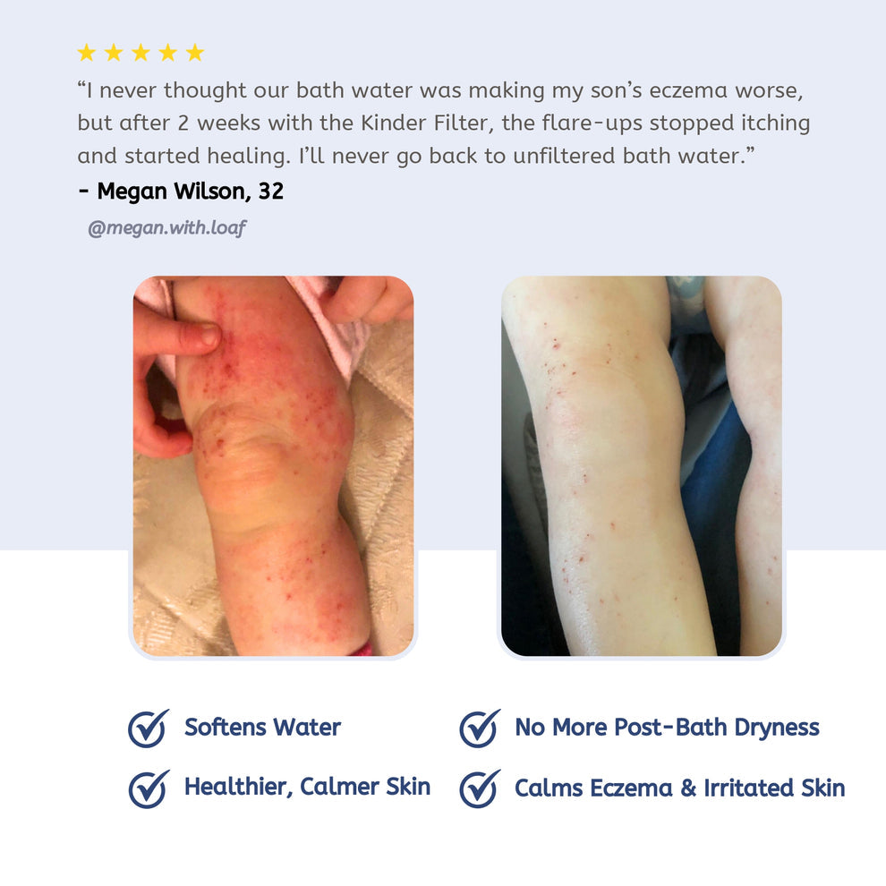 Skincare Bath Filter by Kinder Filter