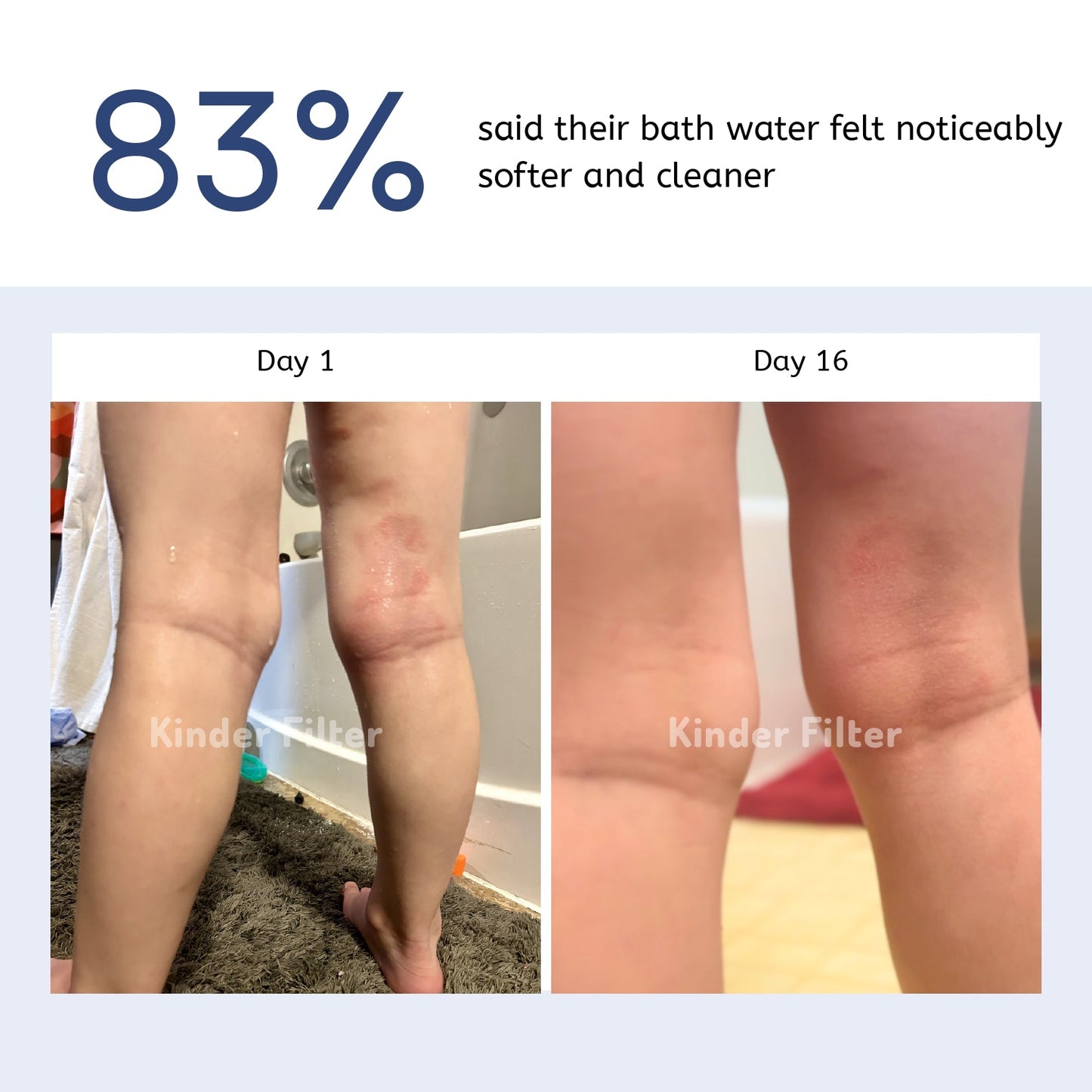 Skincare Bath Filter by Kinder Filter